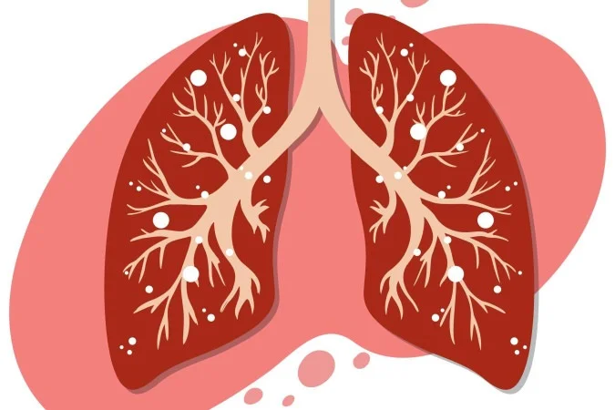 Biópsia líquida avança na detecção de mutações no câncer de pulmão